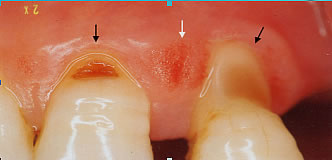 pic-23